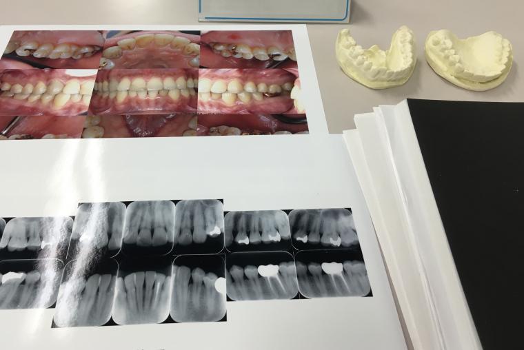 歯周病の勉強会